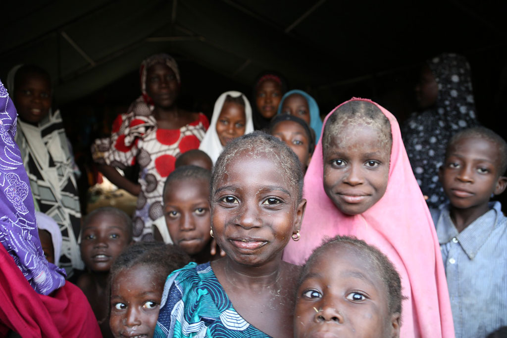 Nigeria Hàng chục nghìn trẻ em có nguy cơ tử vong vì suy dinh dưỡng