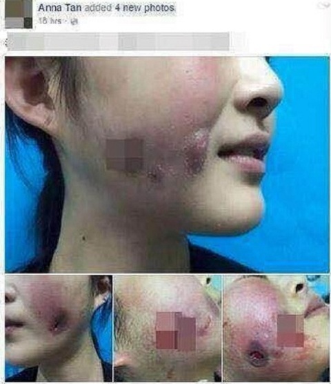 Cần thận trọng khi làm đẹp giá rẻ