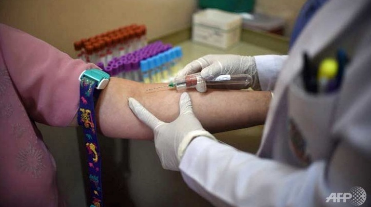 Virus Zika có thể sống trong mắt người và lây lan qua nước mắt