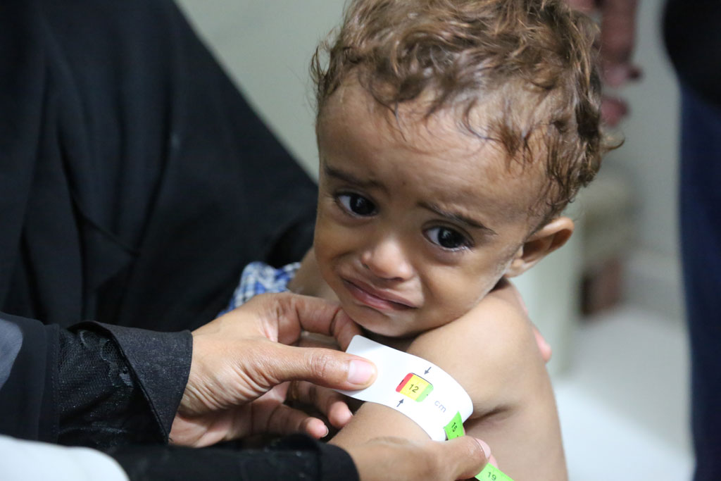 Cần thêm 2,1 tỷ USD để ngăn chặn nạn đói ở Yemen trong năm 2017