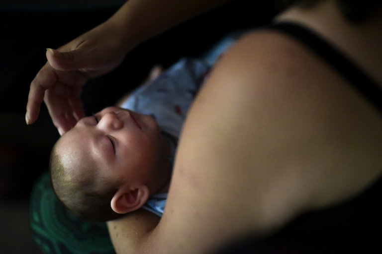 Đáng ngại tỷ lệ trẻ sơ sinh mắc dị tật bẩm sinh vì vi-rút Zika