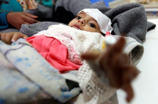Gần 1000 người tử vong vì dịch tả ở Yemen