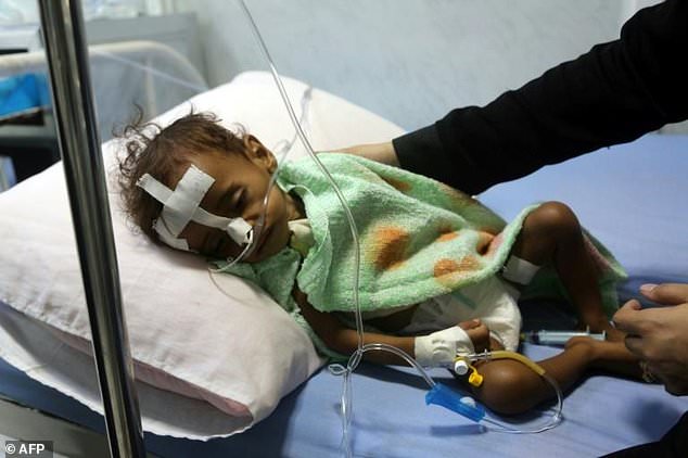 Hơn 11 triệu trẻ em Yemen cần được hỗ trợ nhân đạo khẩn cấp