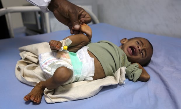 Yemen Hơn 5000 trẻ em thiệt mạng và bị thương vì chiến tranh