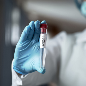 Bất ổn an ninh gây trở ngại cho cuộc chiến chống Ebola ở CHDC Congo