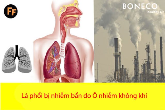 Cần sự chung tay đẩy lùi ô nhiễm không khí