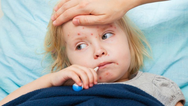 WHO Americas officially free from measles