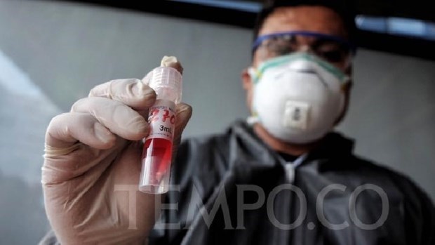 L’Indonésie commence à produire les kits de test rapide de dépistage du COVID-19
