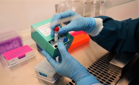 Vinmec a développé avec succès deux kits de dépistage du SARS-CoV-2