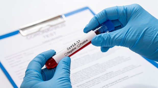Coronavirus 15 jours sans infection intracommunautaire