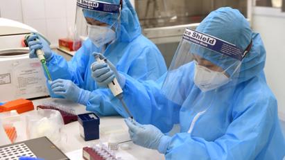 Les laboratoires de tout le pays peuvent traiter 100 000 tests de SARS-CoV-2 OVID-19 par jour