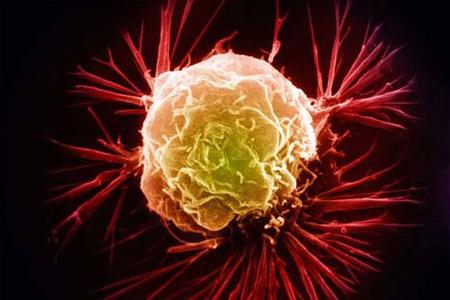 澳科学家发现“饿死”癌细胞新疗法