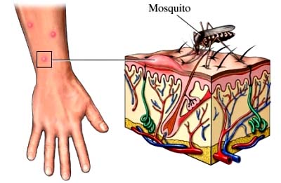 世卫建议到巴西旅游者接种黄热病疫苗