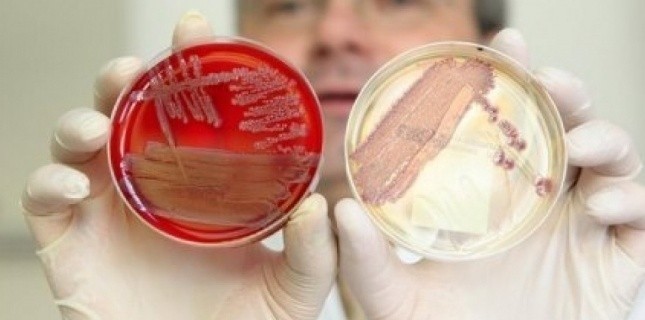 Bactérie E coli le bilan monte à 47 morts en Europe