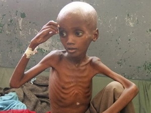 Famine en Somalie 750 000 personnes menacées de mort