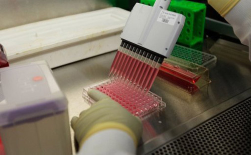 South Africa Scientists discover HIV-neutralising antibodies