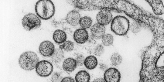 Alerte au virus mortel aux Etats-Unis
