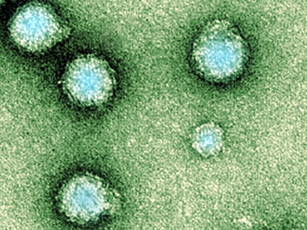 Épidémies de virus étranges à Samoa