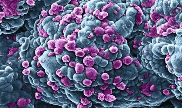 Découverte des mécanismes de la dissémination métastatique dans le cancer du sein