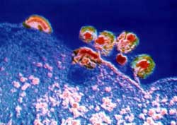 Hy vọng mới trong việc phòng ngừa HIV AIDS