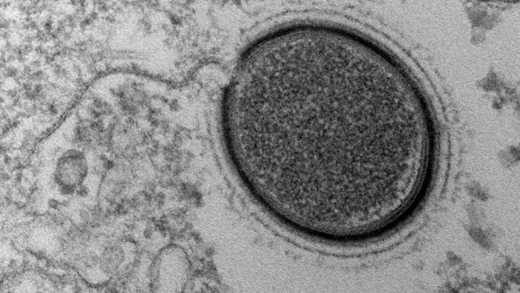 Découverte d un virus géant, daté de 30 000 ans