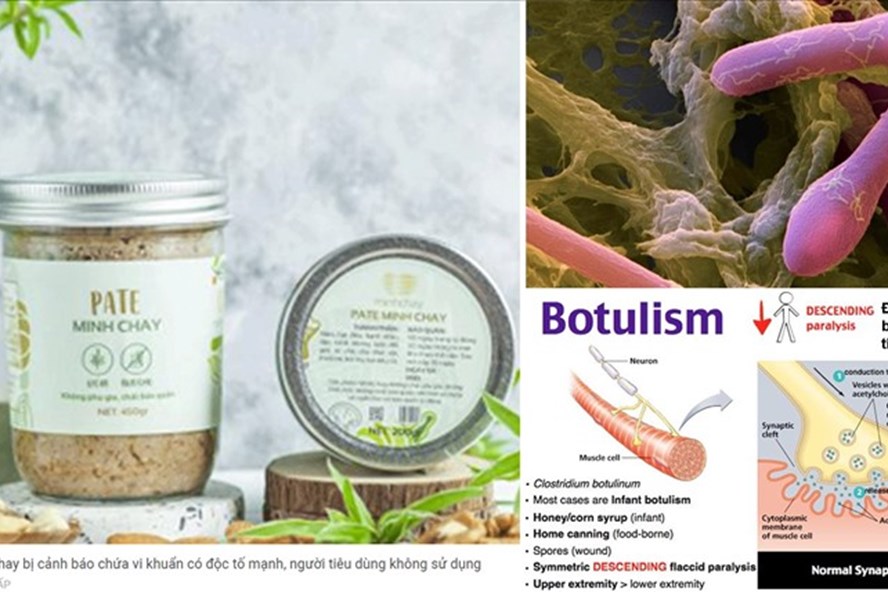Chậm trễ cảnh báo pate Minh Chay gây độc, Cục an toàn thực phẩm nói gì
