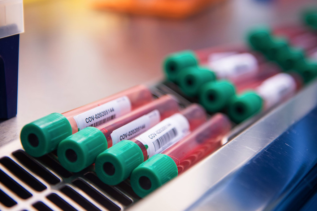 WHO Không có gì bảo đảm vaccine ngừa COVID-19 đang được phát triển sẽ hoạt động
