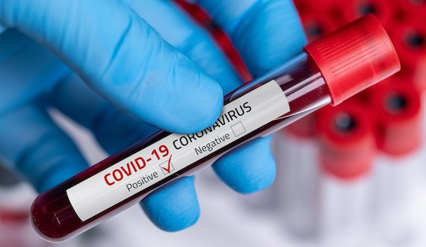 Tình hình dịch COVID-19 trên thế giới Châu Phi đã qua đỉnh dịch