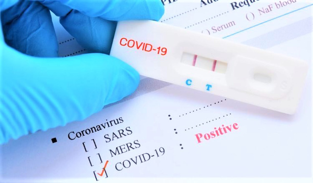 Bộ Y tế lên tiếng về giá xét nghiệm COVID-19