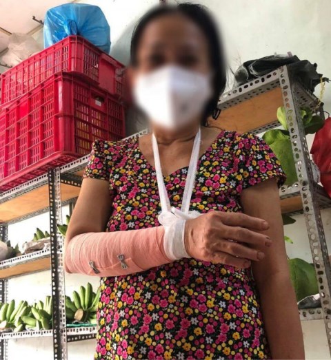 Thông tin “gia đình tổ dân phố đánh người vì tiền trợ cấp” là sai