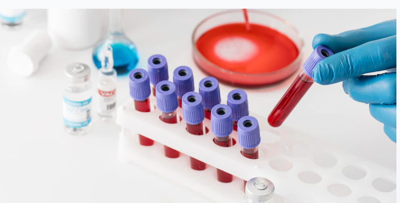 Việt Nam có hơn 6 200 người bị bệnh máu khó đông Hemophilia