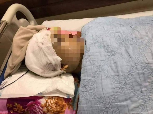 Xử lý nghiêm hành vi tấn công người thực thi công vụ