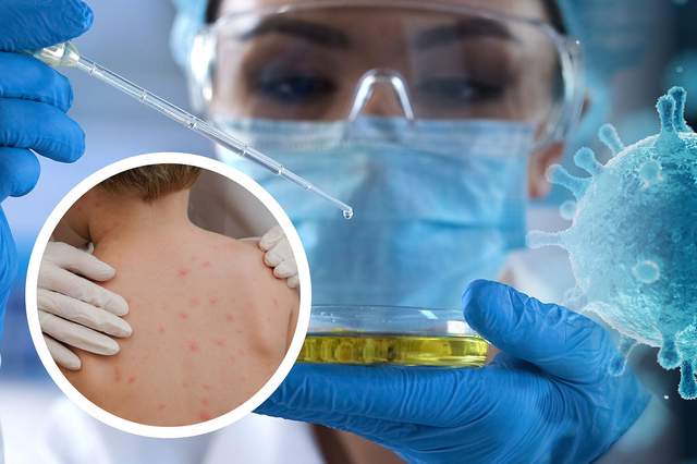 Thế giới tuần qua Cần hành động sớm để kiểm soát dịch bệnh