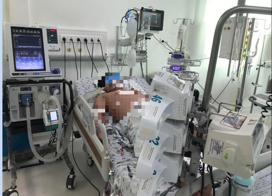 Khẩn trương tổ chức mua sắm dịch truyền Dextran 40 điều trị sốc sốt xuất huyết