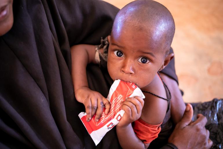 Somalia Hơn nửa triệu trẻ em dưới 5 tuổi đối mặt nguy cơ suy dinh dưỡng cấp tính nghiêm trọng