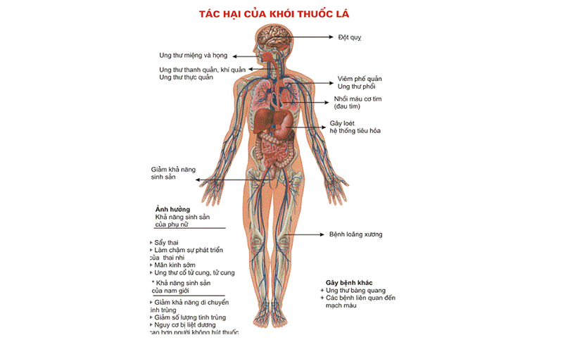 Việt Nam là một trong những nước có tỷ lệ nam giới hút thuốc lá cao nhất thế giới