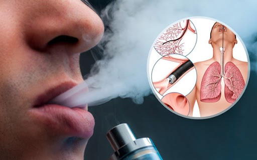Bộ Y tế đề nghị cấm hoàn toàn thuốc lá mới