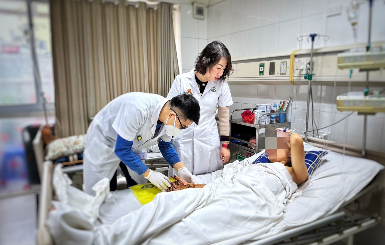 Nam thiếu niên dập nát bàn tay phải do pháo tự chế phát nổ