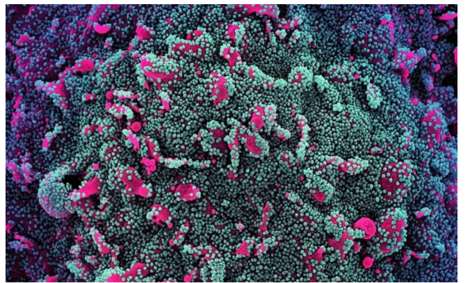 WHO thông báo JN 1 là biến thể được quan tâm mới của SARS-CoV-2