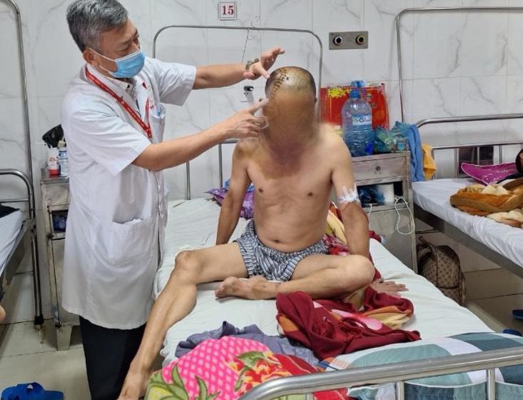 Cấp cứu thành công một bệnh nhân chấn thương sọ não nặng