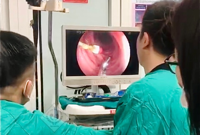 Thái Nguyên Nội soi gây mê lấy diệt tủy răng ở đường tiêu hóa cho bệnh nhi 8 tuổi