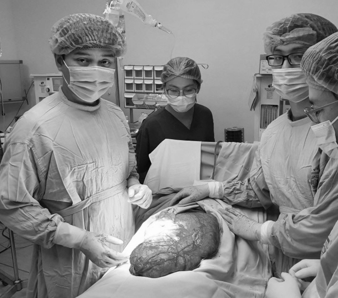 Phẫu thuật thành công cho nam thanh niên có khối u ổ bụng nặng hơn 8 kg