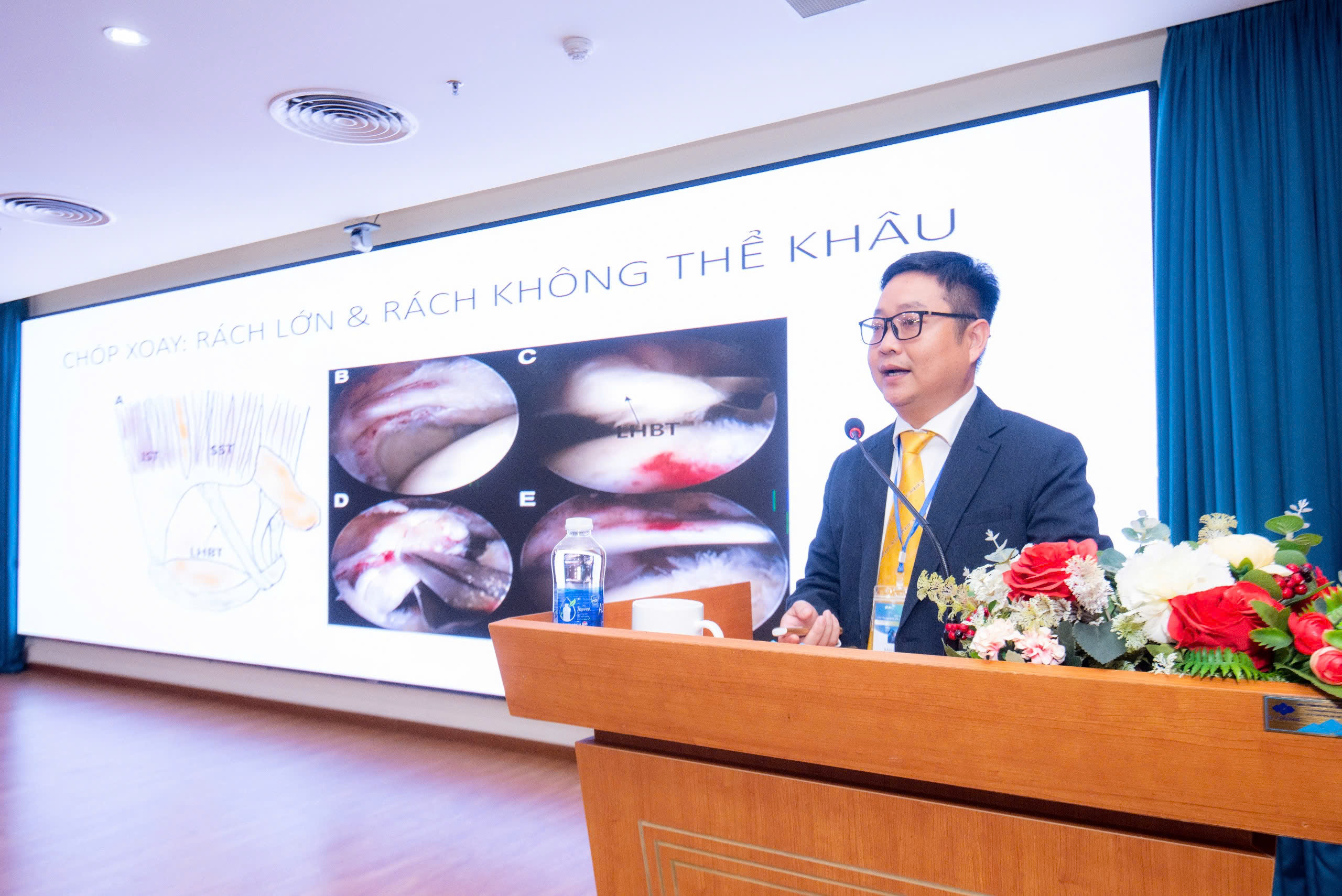 Bác sĩ, chuyên gia y tế lĩnh vực chấn thương chỉnh hình cùng chia sẻ trong điều trị rách chóp xoay