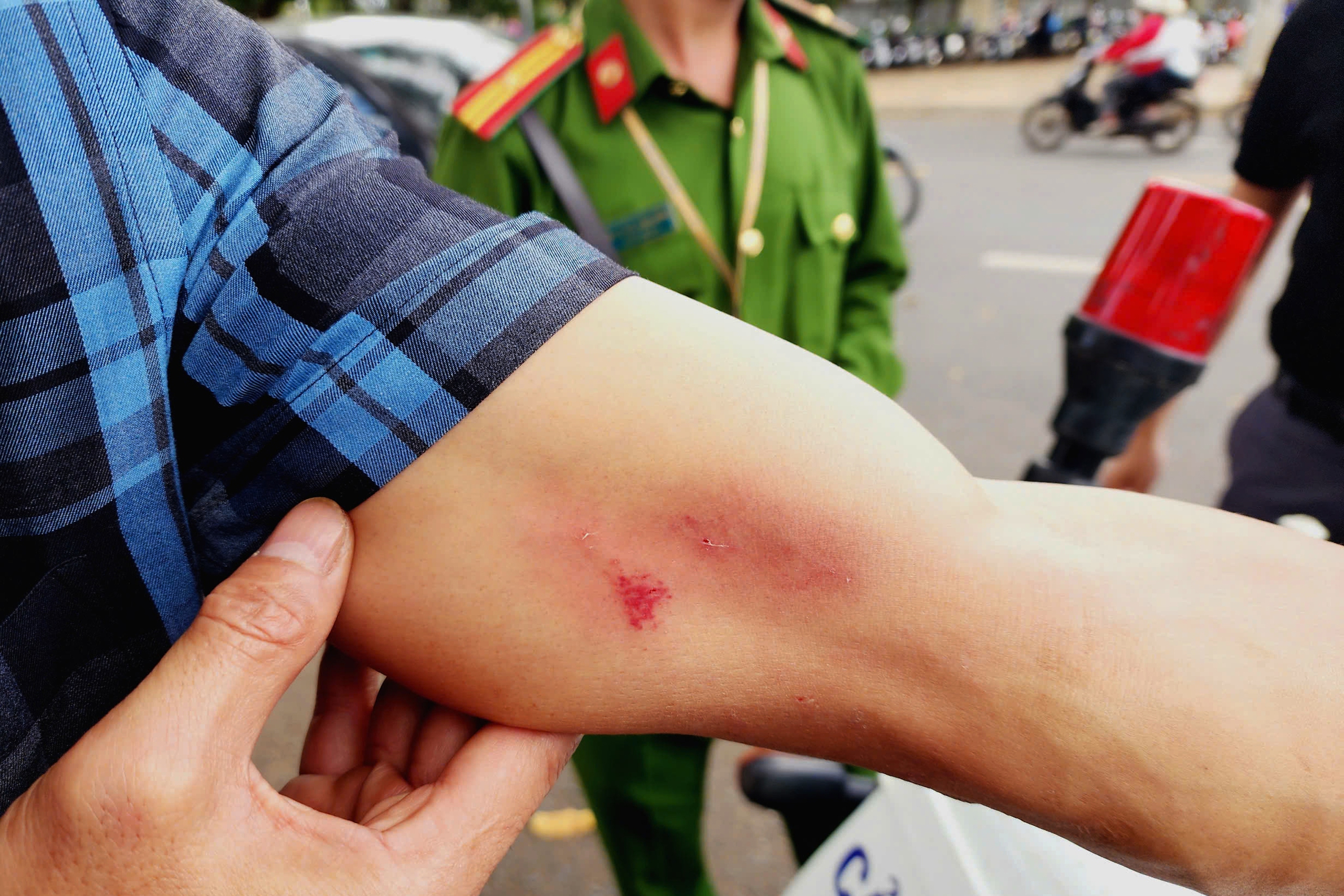 Làm rõ việc một phóng viên bị hành hung khi tác nghiệp