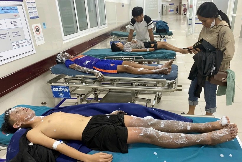 Quảng Bình Bốn học sinh nhập viện cấp cứu do tự chế pháo