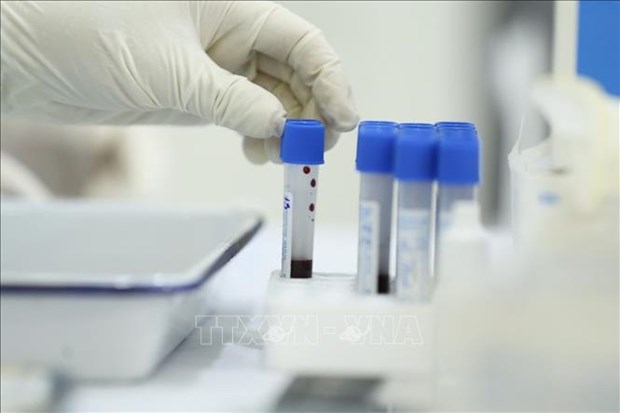 Registran primer caso comunitario de variante Ómicron en Hanoi