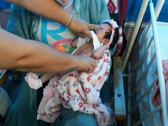 Cuba marca hito importante en cirugía cardiaca en bebés