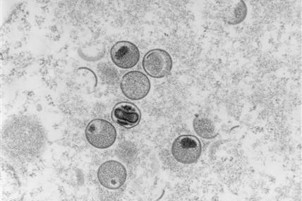 Vietnam aún no ha registrado casos de viruela del mono, pero se proyecta un alto riesgo