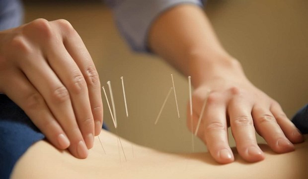 Vietnam y Japón impulsan cooperación en medicina tradicional